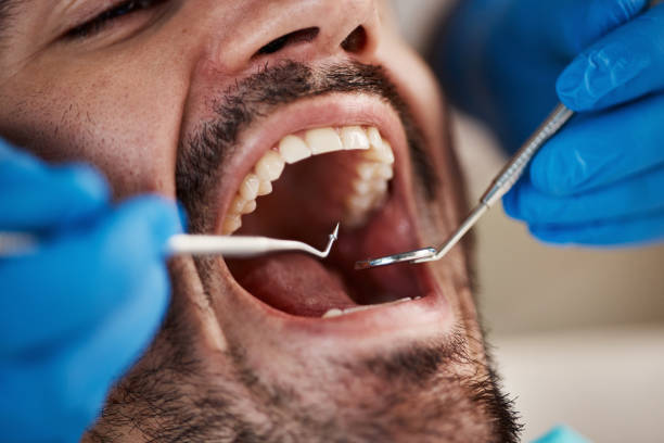 Best Emergency Treatment for Jaw Pain or Injury in Lexington, WA