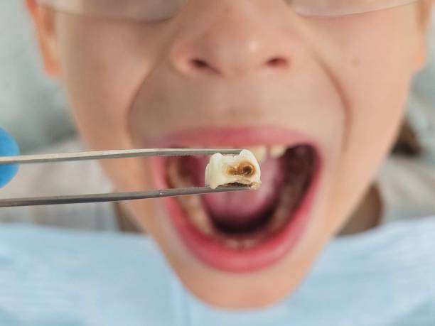 Best Walk-In Emergency Dental Services in Lexington, WA